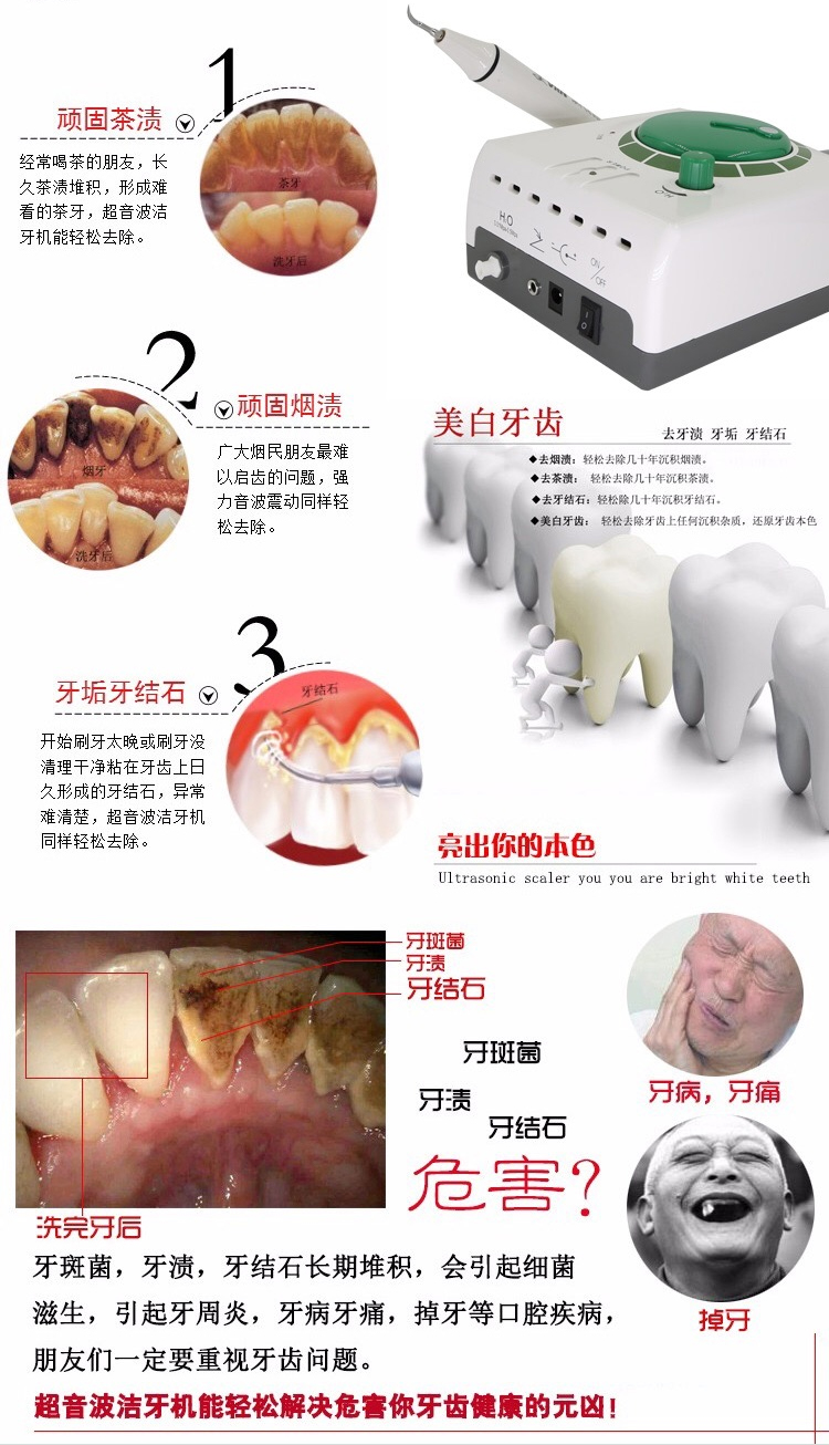 Dental Cleaner Ultrasonic Cleaner Ultrasonic Dental Cleaner Professional Dental Sealed Mobile Phone 12 1