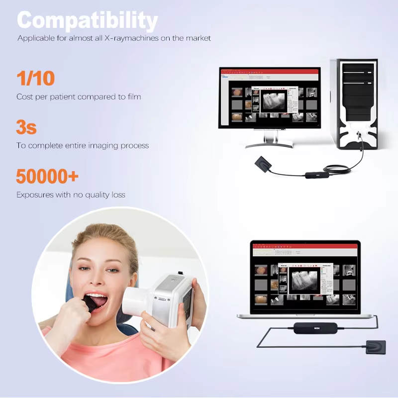 Dental sensor HDR digital intraoral sensor dental x ray machine image system portable dental rvg sensors 50741729062110 .pic