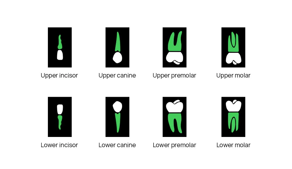6 Dental x-ray machine - Image 11
