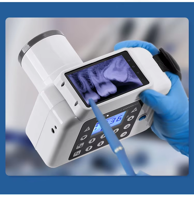 WechatIMG6341 Dental Equipment Digital Versatile Oral Camera with Built-in Display Dental X Ray Machine - Image 5
