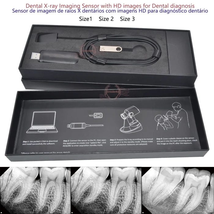 2024 Hot Sale RVG Dental Sensor with Holder Faster/Recycle/Durable USB Dental X Ray Sensor IntraOral Camera Digital RVG Sensor - Image 2