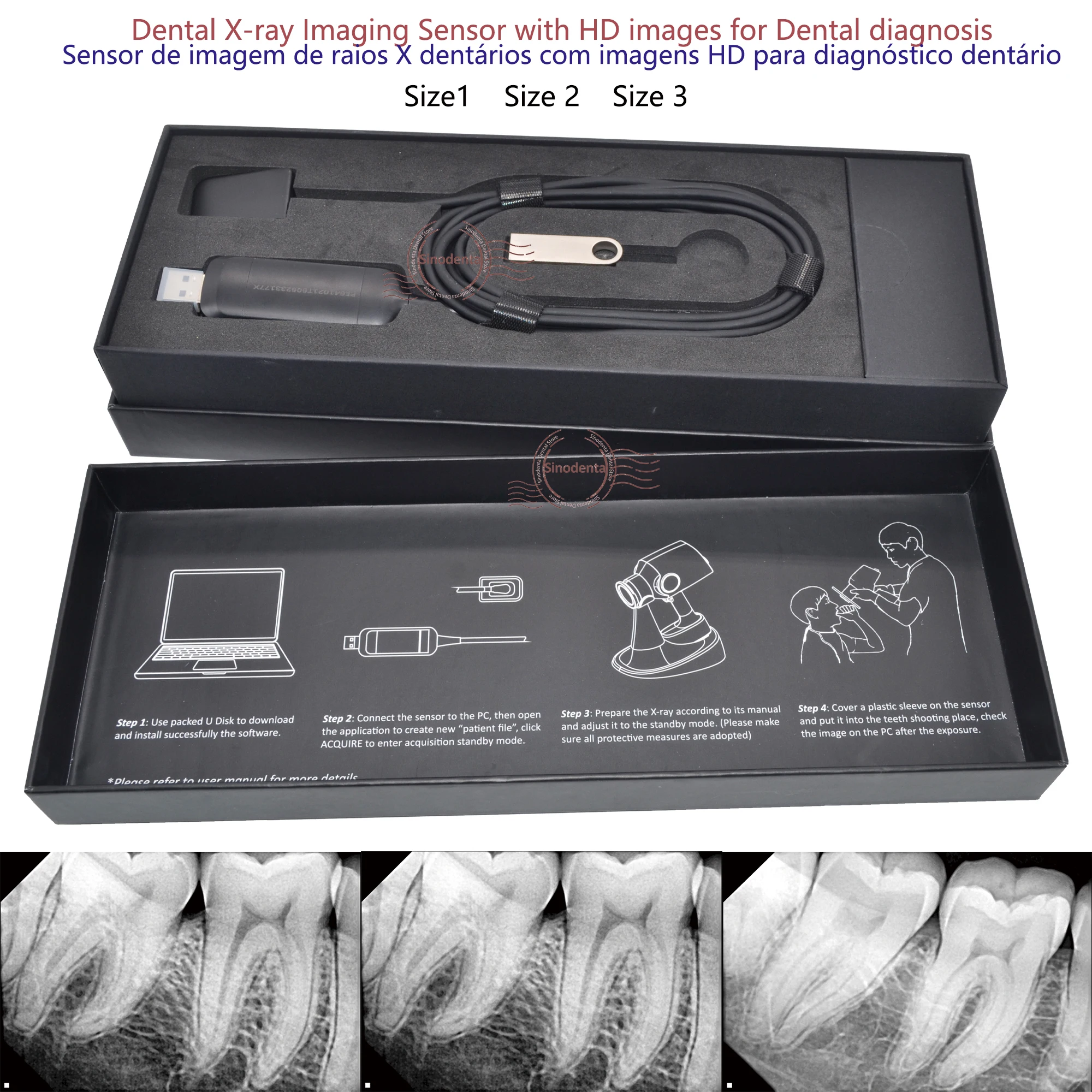 kf-S2687b9ab81244f3194f23897718d700dK 2024 Hot Sale RVG Dental Sensor with Holder Faster/Recycle/Durable USB Dental X Ray Sensor IntraOral Camera Digital RVG Sensor - Image 2