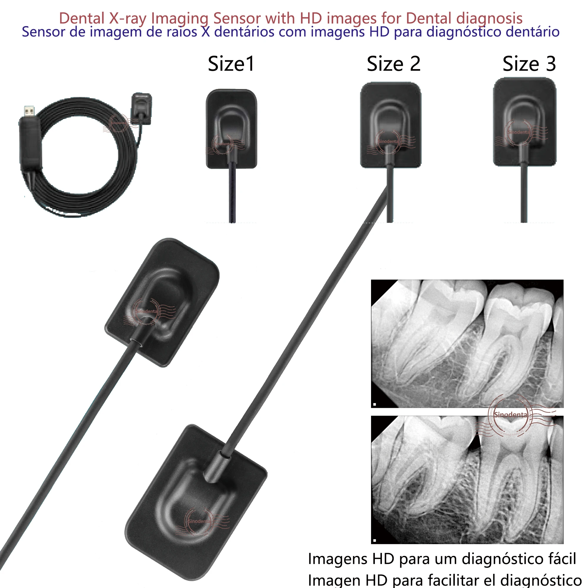 kf-Sefb3f29b40034947b8f8c92dd436e340W 2024 Hot Sale RVG Dental Sensor with Holder Faster/Recycle/Durable USB Dental X Ray Sensor IntraOral Camera Digital RVG Sensor